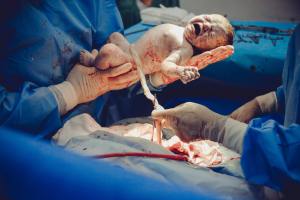 Doctors holding newborn baby with umbilical cord